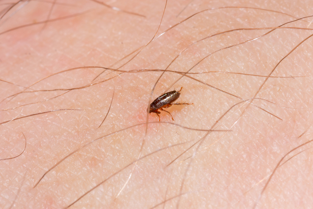 Close view of a flea on skin. 